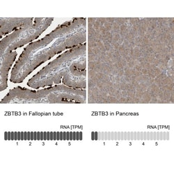 ZBTB3 Antibody, Novus Biologicals 25 &mu;L; Unlabeled:Antibodies, Polyclonal